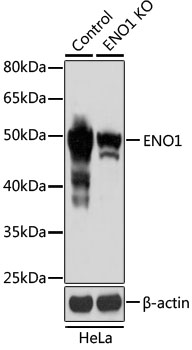 Anti-ENO1 Antibody [KO Validated] (CAB1033)