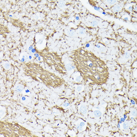 Anti-APP Rabbit Monoclonal Antibody [KO Validated] (CAB17911)