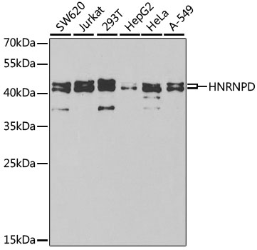 Anti-HNRNPD Antibody (CAB1828)