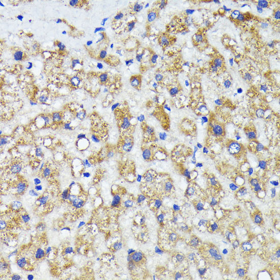 Anti-AMOTL2 Antibody (CAB16723)