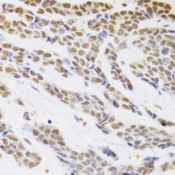 Anti-HDGF Antibody (CAB5347)