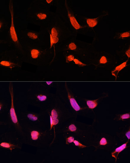 Anti-ZNF264 Antibody (CAB14089)