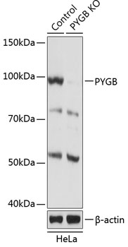 Anti-PYGB Antibody [KO Validated] (CAB19910)