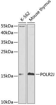 Anti-POLR2J Antibody (CAB1843)