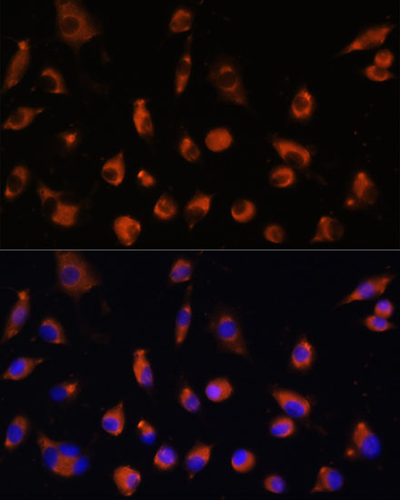 Anti-TMEM25 Antibody (CAB14370)