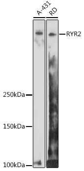 Anti-RYR2 Antibody (CAB0298)