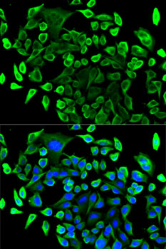 Anti-TAB1 Antibody (CAB5749)