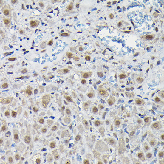 Anti-PFKFB3 Antibody (CAB6945)