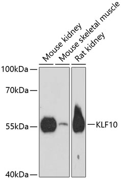 Anti-KLF10 Antibody (CAB13180)