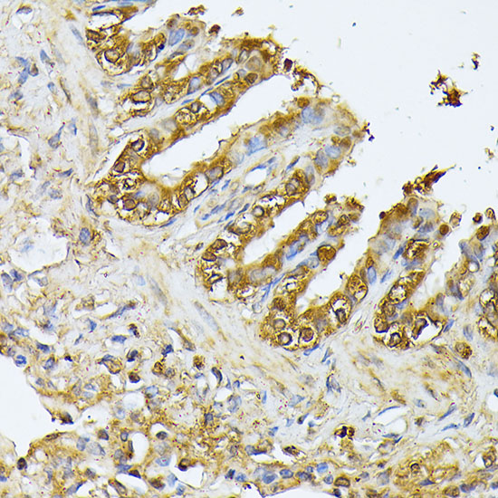 Anti-Parkin Antibody (CAB0968)