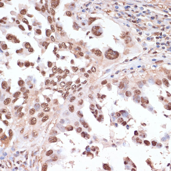 Anti-ITCH Antibody [KO Validated] (CAB15612)