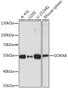 Anti-GORAB Antibody (CAB17245)