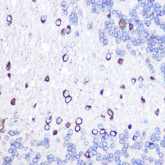 Anti-GOLM1 Antibody (CAB7283)