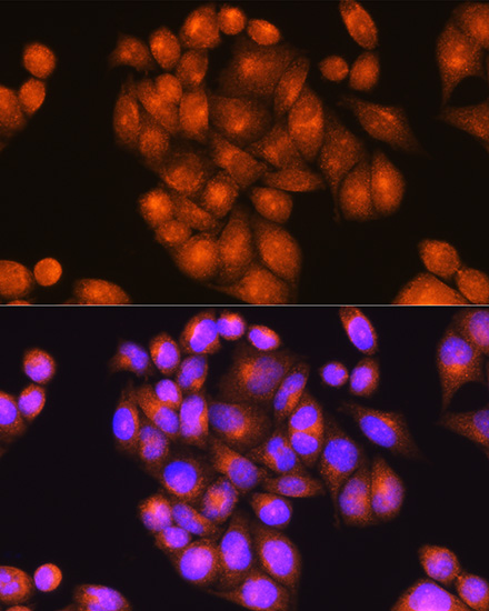 Anti-PSEN2 Antibody (CAB7719)