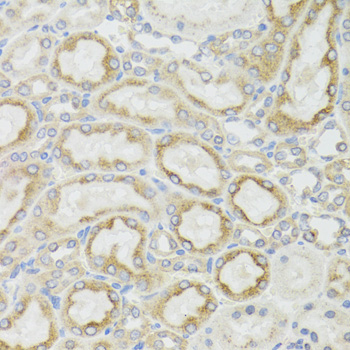 Anti-ND5 Polyclonal Antibody (CAB8135)