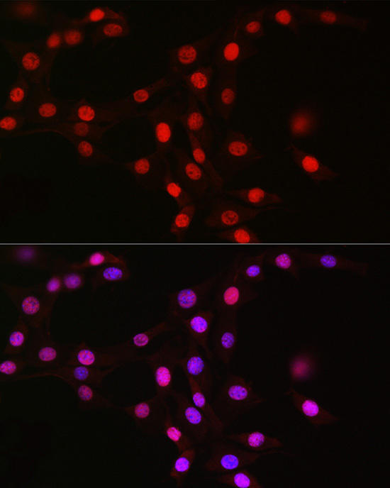 Immunofluorescence analysis of NIH/3T3 cells using MCM2 Rabbit mAb at dilution of 1:100 (40x lens). Blue: DAPI for nuclear staining.