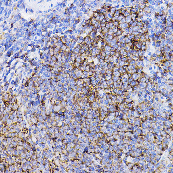 Anti-TGFBR2 Antibody (CAB11788)