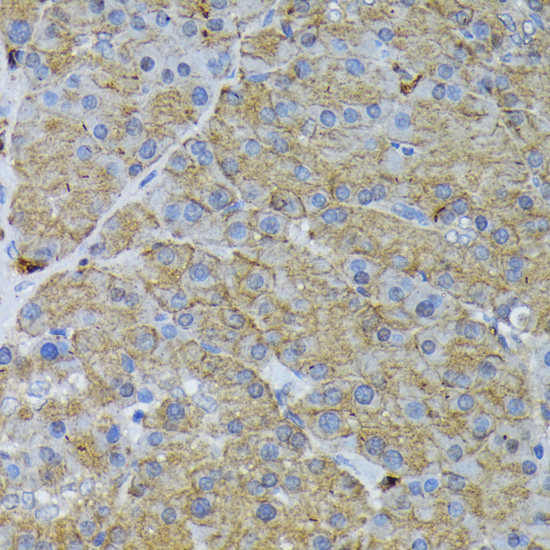 Anti-IRS1 Antibody (CAB16902)