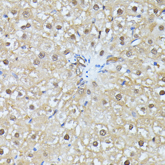 Anti-UBC Antibody (CAB3207)