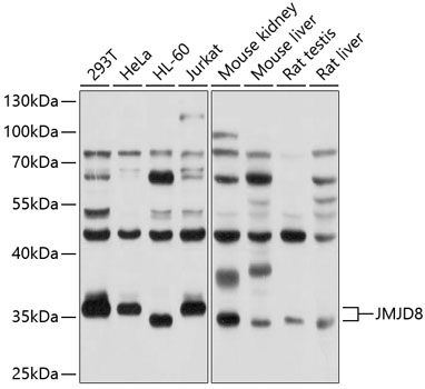 Anti-JMJD8 Antibody (CAB10476)