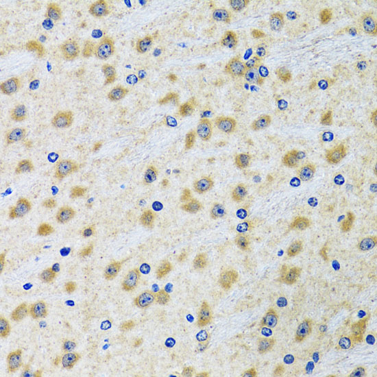 Anti-GAB1 Antibody (CAB6248)