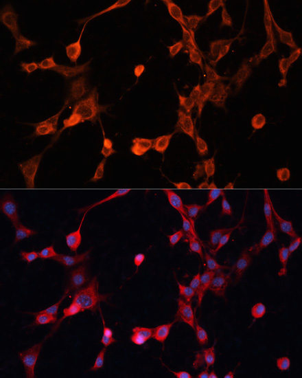 Anti-P Glycoprotein Antibody (CAB1284)