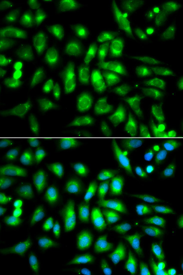 Anti-CHRM2 Antibody (CAB1567)