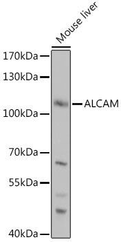 Anti-ALCAM Antibody (CAB2218)