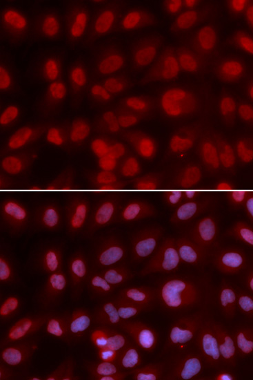 Anti-SIN3A Antibody (CAB1577)