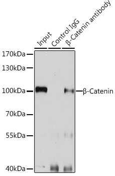 Anti-Beta-Catenin Antibody (CAB11932)