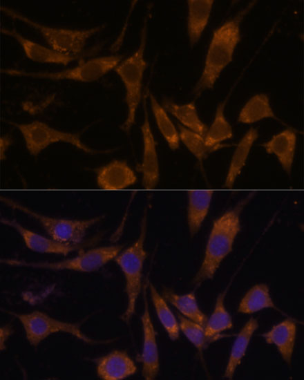 Anti-STAR Antibody (CAB16432)