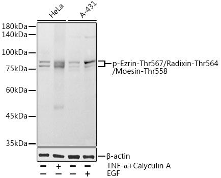 Western blot analysis of extracts of various cell lines, using Phospho-Ezrin-Thr567/Radixin-Thr564/Moesin-Thr558 antibody at 1:1000 dilution. HeLa cells were treated by TNF-ÃŽÂ± (20 ng/ml) and Calyculin A (100 nM) at 37Ã¢â€žÆ’ for 30 minutes after serum-starvation overnight. Secondary antibody: HRP Goat Anti-Rabbit IgG (H+L) at 1:10000 dilution. Lysates/proteins: 25ug per lane. Blocking buffer: 3% nonfat dry milk in TBST. Detection: ECL Basic Kit. Exposure time: 10s.