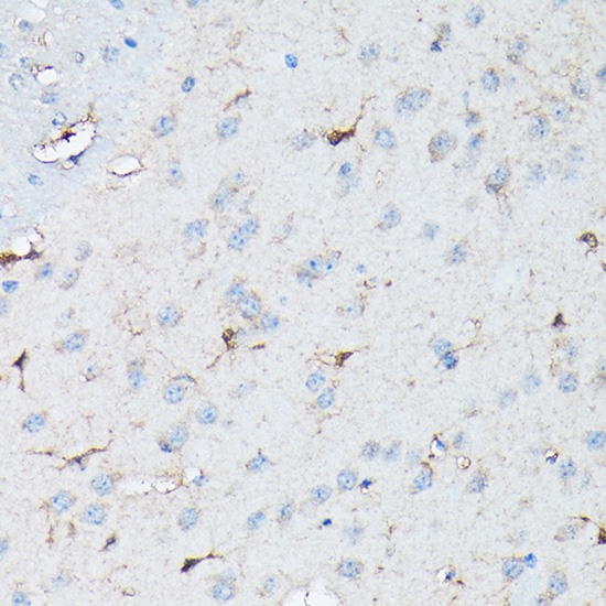 Anti-NLRP1 Antibody (CAB16212)