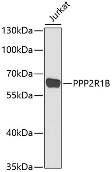 Anti-PPP2R1B Antibody (CAB6703)