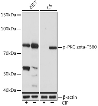 Anti-Phospho-PKC zeta-T560 Antibody (CABP1149)