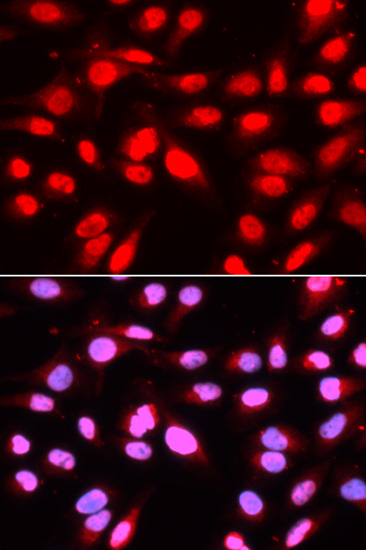 Anti-U2AF2 Antibody (CAB1936)