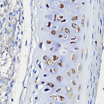 Anti-COMP Antibody (CAB13963)