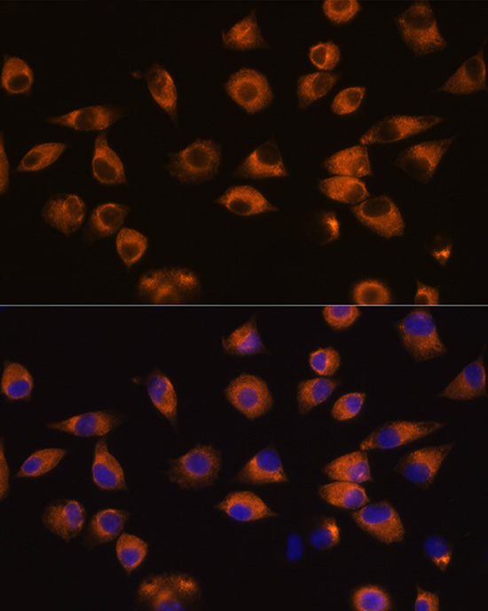 Anti-EPHA5 Antibody (CAB14238)