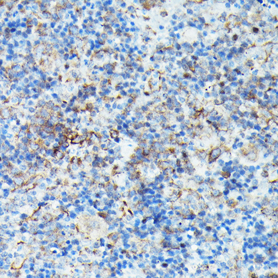 Anti-Phospho-VASP-S239 Antibody (CABP0187)