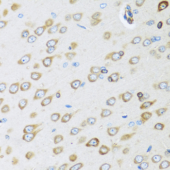 Anti-OGN Antibody (CAB6679)