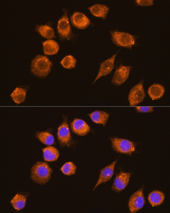 Anti-NAGA Polyclonal Antibody (CAB9942)