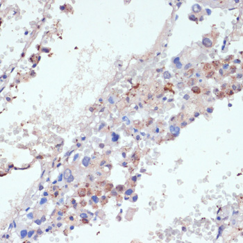 Anti-Protein Wnt-5b Polyclonal Antibody (CAB8313)