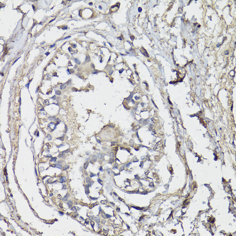 Anti-BAP1 Antibody (CAB6533)