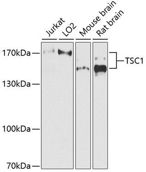 Anti-TSC1 Antibody (CAB0720)