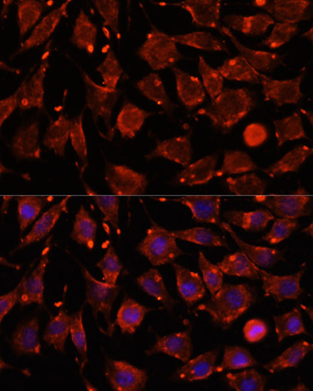 Anti-ITSN2 Antibody (CAB16525)