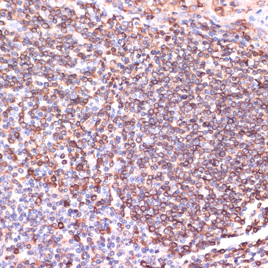 Anti-TPD52 Antibody (CAB10254)