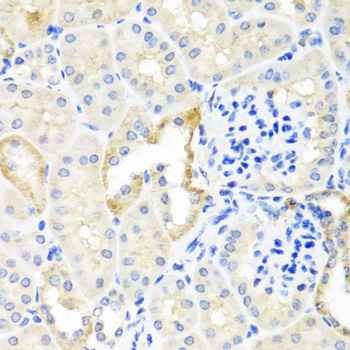 Anti-TDGF1 Antibody (CAB1065)