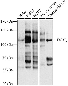 Anti-DGKQ Antibody (CAB3825)