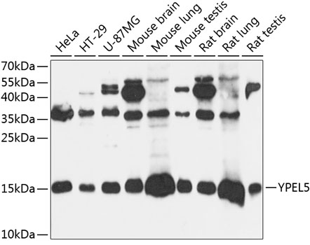 Anti-YPEL5 Antibody (CAB14331)