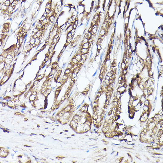 Anti-MLST8 Antibody (CAB13599)